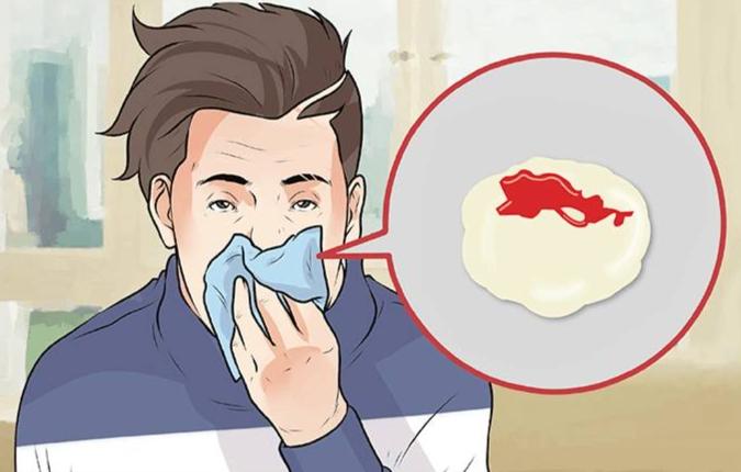 黴漿菌感染症狀