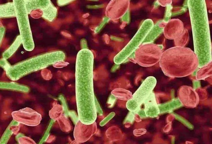 沙門氏菌感染飲食