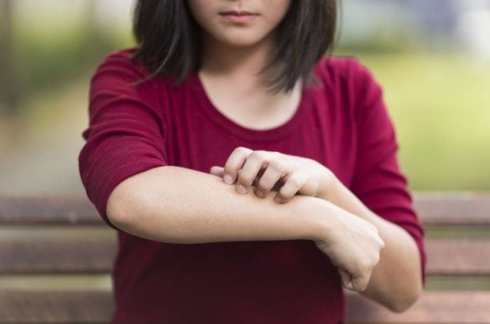 皮膚黴菌感染治療