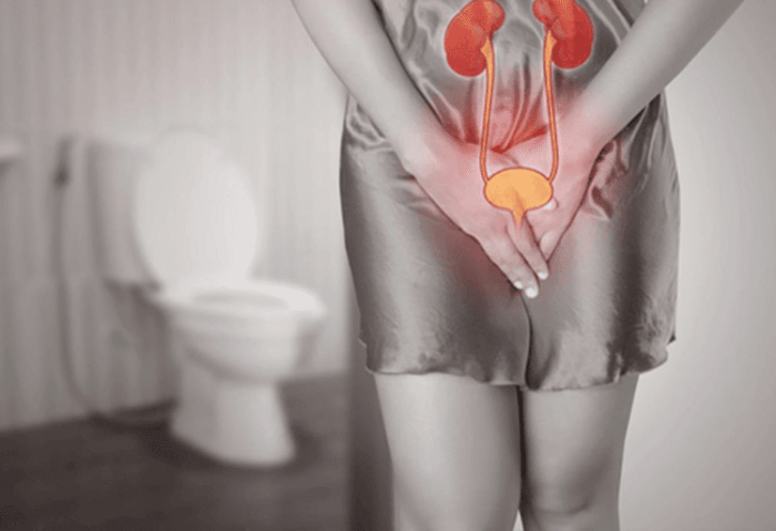 泌尿道感染治療