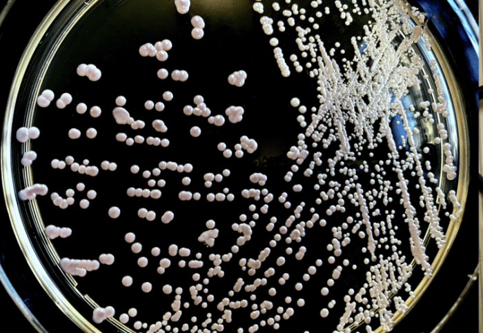 念珠菌感染症狀