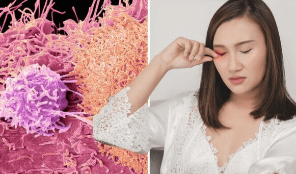 念珠菌感染治療