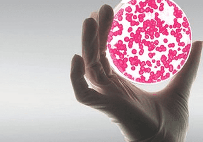 念珠菌感染的治療方法