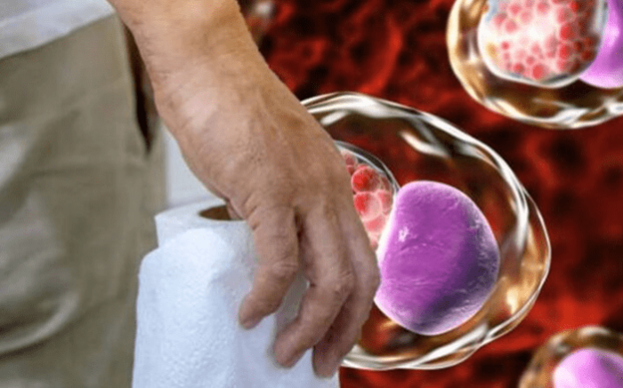 念珠菌感染症狀