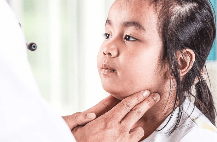 黴漿菌感染治療